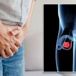Top Warning Signs of Testicular Cancer in Young Men